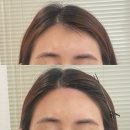 헤어아르니 이미지