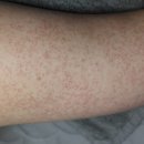 서귀포한의원 이미지