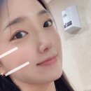 아루다의원 | 서면 피부과에서 "텐써마 리프팅" 300샷 받고 왔어요, 효과. 아픔 강도 솔직 후기