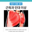 엉덩이가 아파요! 걸을 때 앉을 때 통증 원인 치료 이미지