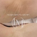루리스킨