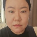 여수센텀정형외과의원 | 여수학동피부과 백만년만에 턱보톡스 맞으러간 후기