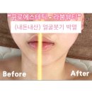 “관리 받고 꿀광폭발✨ 구로 라붐뷰티 작은얼굴 관리 내돈내산 리얼 후기”