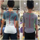 에이스콥 | 어린이 척추측만증(척추옆굽음증) 운동으로 척추측만 교정을 완벽하게