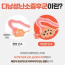 방촌 허약국 앞 | [20대 난임일기] 나팔관조영술 후기..이렇게 아플 수가 있나