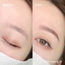 의정부경전철 송산역 이미지