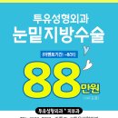 눈밑지방재배치 안색이 밝고 화사해지는 수술 이미지