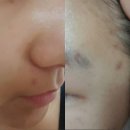 조에오가닉 | [조에오가닉4일째후기]