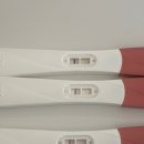 서울산부인과의원 | 시험관 1차 성공 후기 3일배양 5일배양 차이 신선이식 동결이식 하남 서울마리 산부인과