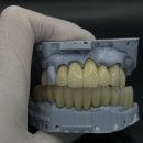 뉴치과기공소 이미지