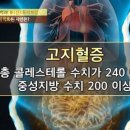 고지혈증 관리 위해 식단 바꿨더니 이미지