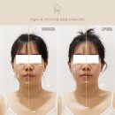 디아에스테틱 - 수성구 | 부천피부관리 디아에스테틱 두골비 후기, 부천역피부관리 윤곽 밸런스 케어 경험