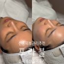 에이치제이케어솔루션 | 선릉피부관리 추천 40대 피부고민 슈퍼젝션 블랙 후기 프라블