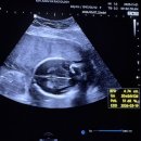 효성한의원 | [22주차 임산부] 주수별 증상 22w