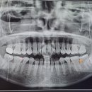 안아프니치과의원 이미지