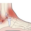 송정공원역 이미지