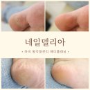 마곡 발각질제거 맨발에 자신감 생기는 네일델리아 페디플래닝
