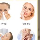 비염과 부비동암 차이 급성부비동염 꼭 알아야 할 3가지 증상 이미지
