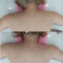 양주마사지 옥정동에스테틱 윤메디테라피 승모근 통증관리 후기