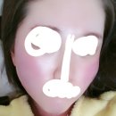 고운미의원 | 대구 동성로 홍조(주사피부염) 치료 기록 1 (병원정보+비용+수란트라+실비보험)