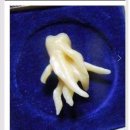 죽파치과의원 | 포항 사랑니 발치 죽파치과 리얼 후기