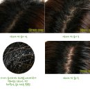 신진이엔씨 | [아미치스트레스싹]과다한업무와 스트레스로 머리가 지끈거릴때! 아미치스트레스싹!
