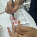 더손 정형외과의원 | [울산 북구]더편한 정형외과 손가락배농술 후기 이정도면 정형외과 단골이되