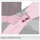 (검사) Knee joint palpation(그림그리기) 이미지