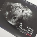 (주)비스토스 | 임신 5주차, 임신확인증 발급 그리고 하혈 (산부인과 추천)