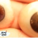 코리아의안센터 티스토리
