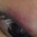 최진수안과의원 이미지