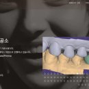 본치과기공소 이미지