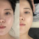 다온에스테틱 - 수원시 장안구 | 사직동 피부관리 여름 전 필수 관리 다온에스테틱 비타민 앰플 후기