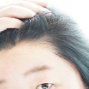 모에뜨 | 여자 천연 탈모 샴푸 추천 탈모예방 두피관리 모에뜨 탈모완화샴푸 후기