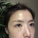 벨라센토 | 점뺀후 세살크림 필요할때 벨라센토 인텐시브크림