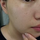 특허법인에스알비 | 에슬 essl 알비타치온 브라이토닝 크림&패치 에슬알비타치온기미흡착세트 기미,잡티 집중 홈케어 후기