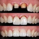 훤치과기공소 이미지