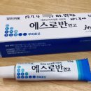 발가락 티눈 냉동치료 # 치료비 # 보험처리