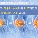 연골 이미지