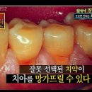 치약대신 소금을 2달 사용해보았습니다.[내용추가] 이미지