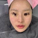 수수수 뷰티 | 연남동 토탈뷰티샵 수수수네일아쿠아필링 관리 후기｜전후 비교로 보는 피부결 변화