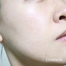 림프랩 네이버블로그