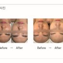 더건강여기테라피