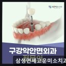 연세미치과의원 | 서울 임플란트 잘하는곳 삼성연세고운미소치과의원 믿음 가는 협진 시스템