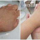 인셀덤신