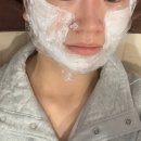 쏘.핏 | 강남역 세르프 피부과 네스트 웨딩핏 피부관리 후기