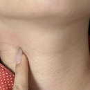 한마음신용협동조합 | 갑상선 결절 초음파 후기 [갑상선 암 의심] 창원 마산