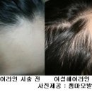 김헤어라인 이미지