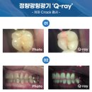 치아정밀치과기공소 이미지