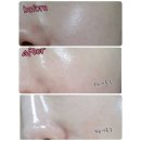 앵콜 공구:) 효과대박, 하이드로겔 리프팅 마스크+미백/주름 앰플 공구♥